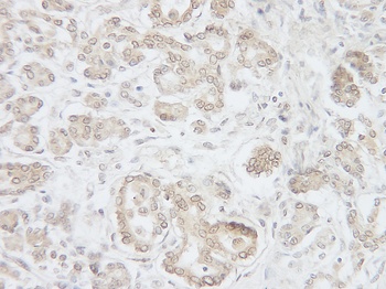 IL-17D Antibody