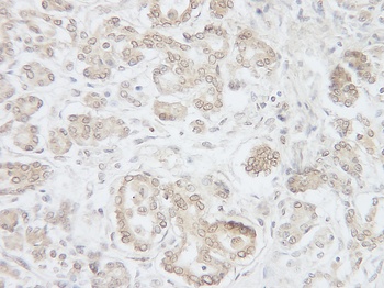 IL17D Antibody