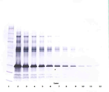 IGFBP1 Antibody