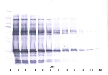 IGF-BP1 Antibody