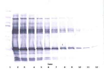 IGFBP1 Antibody