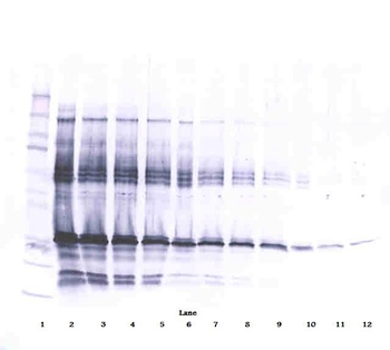 IGFBP1 Antibody