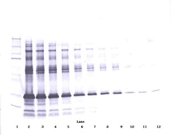 IGFBP1 Antibody