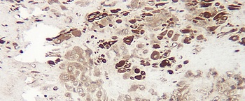 IGFBP1 Antibody