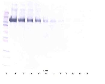 EGFR Antibody