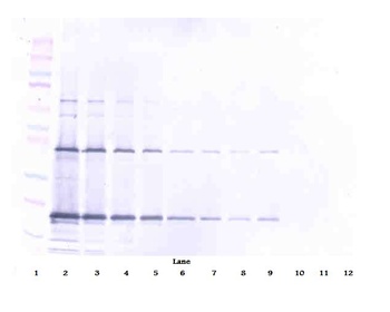 TRAIL Antibody