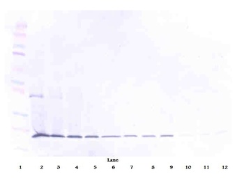TRAIL Antibody