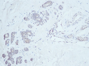 Heregulin-beta1 Antibody