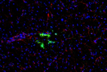 Cxcl10 Antibody
