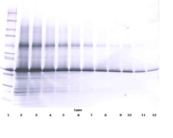 IGF-BP3 Antibody