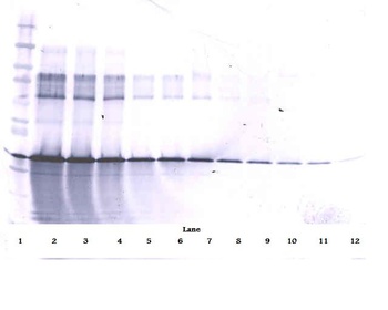 IGF-BP3 Antibody