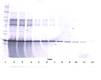 IGFBP3 Antibody