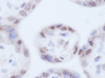 IGFBP3 Antibody