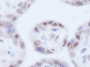IGF-BP3 Antibody