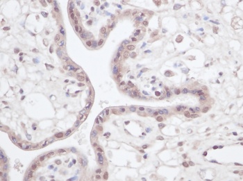 IGF-BP3 Antibody
