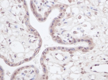 IGFBP3 Antibody