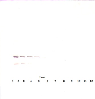 IGFBP7 Antibody