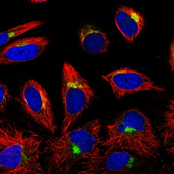 IGFBP7 Antibody