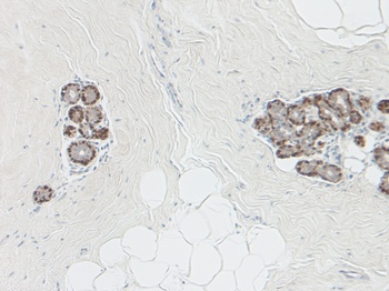 SERPINB5 Antibody
