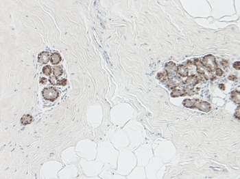 Maspin Antibody