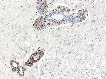 Maspin Antibody