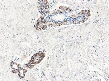 SERPINB5 Antibody