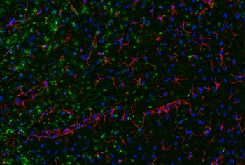 Ifng Antibody