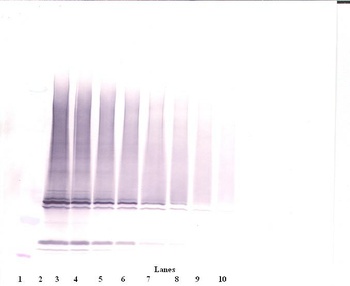 IL-17F Antibody