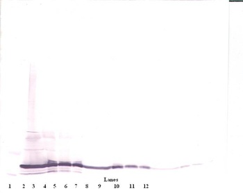 IL-17F Antibody