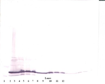 IL17F Antibody