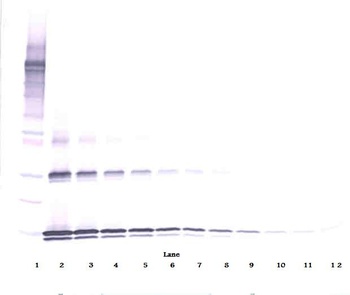 IL31 Antibody