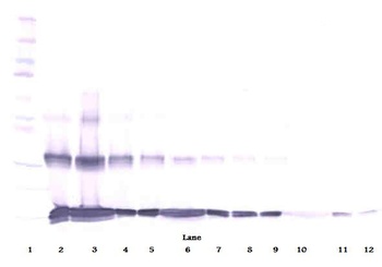 IL31 Antibody
