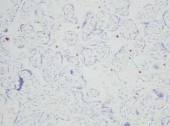 RETN Antibody