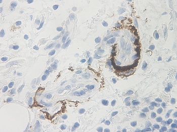 NGF Antibody