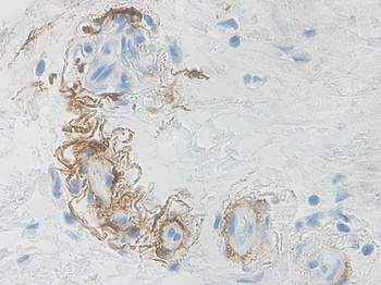 NGF Antibody