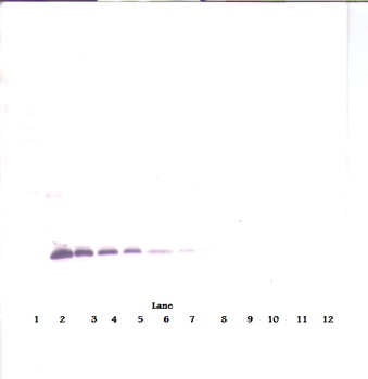 TIMP1 Antibody