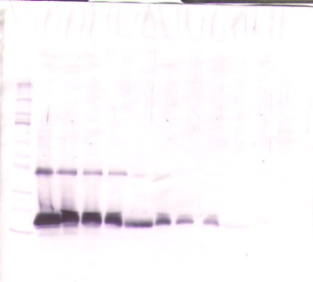 TIMP1 Antibody