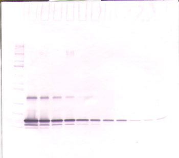 TIMP1 Antibody