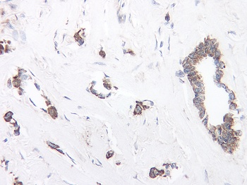 TIMP-1 Antibody