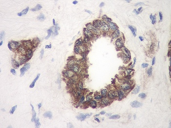 TIMP-1 Antibody