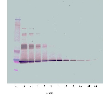 IL-6 Antibody