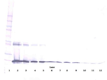 IL-6 Antibody