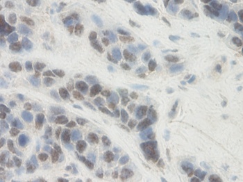 PAI-1 Antibody