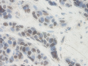 SERPINE1 Antibody