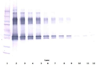 SERPINA12 Antibody