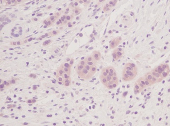 MIA2 Antibody