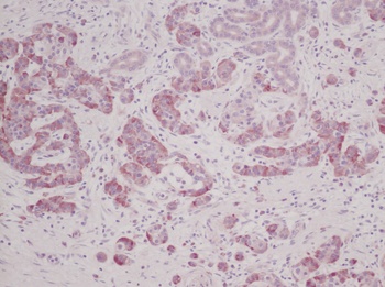 MIA2 Antibody