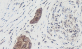 WNT1 Antibody