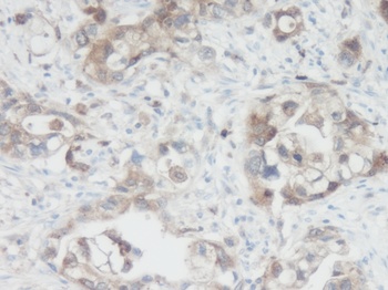 LGALS3 Antibody