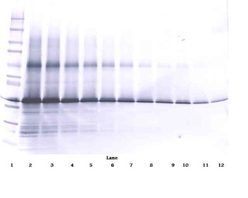 IGFBP3 Antibody (Biotin)
